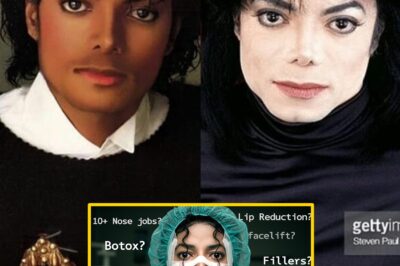 How Much Plastic Surgery Did Michael Jackson Actually Have?