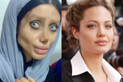 Before 50 plastic surgeries, the girl with the face “like” Angelina Jolie used to be this beautiful