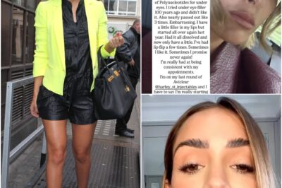 Every surgical procedure Frankie Bridge has undergone – from ‘lip flip’ to under-eye filler!