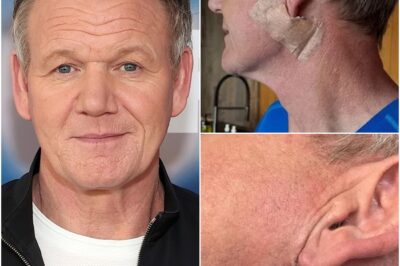 Gordon Ramsay shares shock skin cancer news as he undergoes surgery!