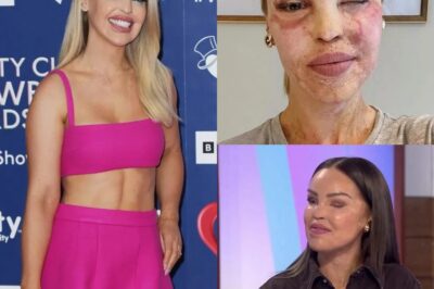 Loose Women star planning more surgery on face years after horrifying attack