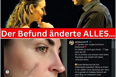 Schock-Befund nach Gesichts-OP: Ekaterina Leonova und der mutige Kampf gegen die schleichende Gefahr
